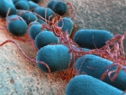 Elektronický nos z bakteriálních nanodrátků slibuje průlom v diagnostice
