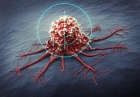 Důmyslné nanočástice s RNA posilují reakci imunity proti nádorům