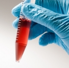 Acelulární nanokompozitní živé hydrogely jsou novým biomateriálem pro regenerativní medicínu