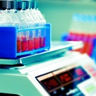 Použití prachu vylepšuje možnosti forenzní analýzy DNA